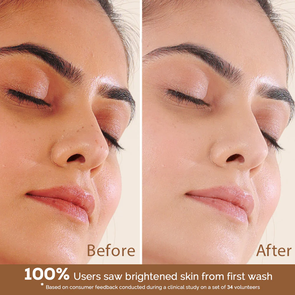 تاثیر کرم ضد لک بر روی پوست چگونه است؟